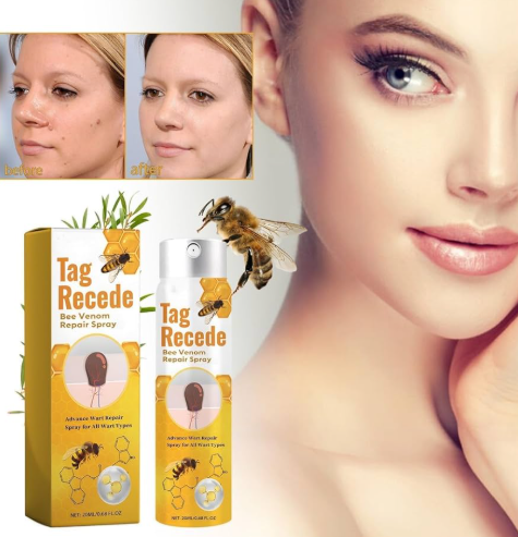 Eliminador de Verrugas y Lunares Tag Recede