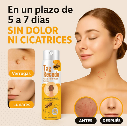 Eliminador de Verrugas y Lunares Tag Recede